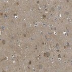 Anti-PIEZO2 Antibody
