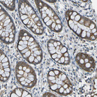 Immunohistochemical staining of human colon shows weak cytoplasmic positivity in glandular cells.