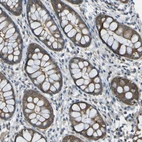 Immunohistochemical staining of human colon shows weak cytoplasmic positivity in glandular cells.