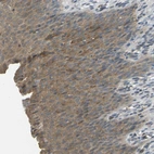 Immunohistochemical staining of human urinary bladder shows moderate cytoplasmic positivity in urothelial cells.