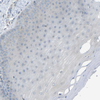 Immunohistochemical staining of human cervix, uterine shows no positivity in squamous epithelial cells as expected.