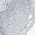 Immunohistochemical staining of human cervix, uterine shows no positivity in squamous epithelial cells as expected.