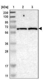 Lane 1: Marker [kDa] 230, 130, 95, 72, 56, 36, 28, 17, 11_br/_Lane 2: Human cell line RT-4_br/_Lane 3: Human cell line U-251MG sp