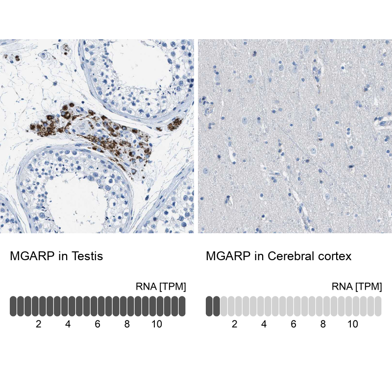 Anti-MGARP Antibody
