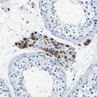 Immunohistochemical staining of human testis shows strong cytoplasmic granular positivity in Leydig cells.