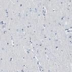 Immunohistochemical staining of human cerebral cortex shows no positivity in neurons as expected.
