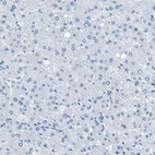 Immunohistochemical staining of human liver shows no positivity in hepatocytes as expected.