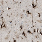 Anti-TSPAN3 Antibody