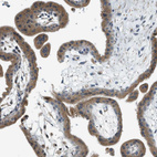 Immunohistochemical staining of human placenta shows moderate cytoplasmic positivity in trophoblastic cells.