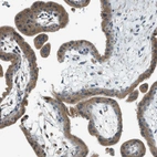 Immunohistochemical staining of human placenta shows moderate cytoplasmic positivity in trophoblastic cells.