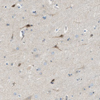 Immunohistochemical staining of human cerebral cortex shows moderate cytoplasmic positivity in neurons.