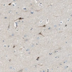 Immunohistochemical staining of human cerebral cortex shows moderate cytoplasmic positivity in neurons.