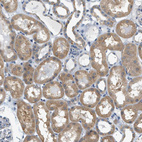 Immunohistochemical staining of human kidney shows moderate cytoplasmic positivity in cells in tubules.