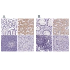Immunohistochemical staining of human colon, liver, lymph node and pancreas using Anti-ASGR2 antibody HPA015998 (A) shows similar protein distribution across tissues to independent antibody HPA014899 (B).