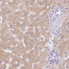 Immunohistochemical staining of human liver shows high expression.