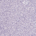 Immunohistochemical staining of human pancreas shows low expression as expected.