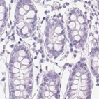 Immunohistochemical staining of human colon using Anti-ASGR2 antibody HPA015998.