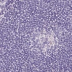 Immunohistochemical staining of human lymph node using Anti-ASGR2 antibody HPA015998.