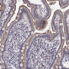 Immunohistochemical staining of human duodenum shows strong membranous positivity in glandular cells.