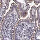 Immunohistochemical staining of human duodenum shows strong membranous positivity in glandular cells.