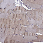 Immunohistochemical staining of human skeletal muscle shows moderate cytoplasmic positivity in myocytes.