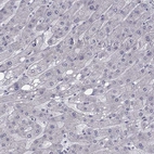 Immunohistochemical staining of human liver shows no positivity in hepatocytes as expected.