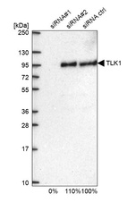 Western blot analysis in U2OS cells transfected with control siRNA, target specific siRNA probe #1 and #2, using Anti-TLK1 antibody. Remaining relative intensity is presented.