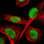 Immunofluorescent staining of human cell line U-251 MG shows localization to nucleus.