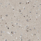 Immunohistochemical staining of human cerebral cortex shows moderate granular cytoplasmic positivity in neurons.