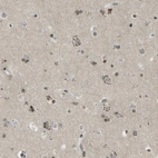Immunohistochemical staining of human cerebral cortex shows moderate granular cytoplasmic positivity in neurons.