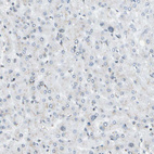 Immunohistochemical staining of human liver shows very weak positivity in hepatocytes as expected.