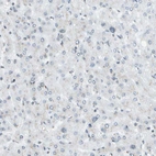 Immunohistochemical staining of human liver shows very weak positivity in hepatocytes as expected.