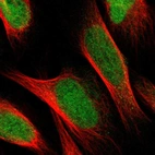 Immunofluorescent staining of human cell line U-2 OS shows localization to nucleoplasm.
