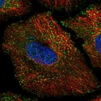 Immunofluorescent staining of human cell line HeLa shows localization to vesicles.