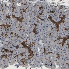 Anti-TDRKH Antibody