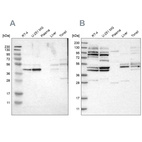 Western blot analysis using Anti-WDR53 antibody HPA016420 (A) shows similar pattern to independent antibody HPA019332 (B).