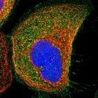 Immunofluorescent staining of human cell line A-431 shows localization to plasma membrane & cytosol.