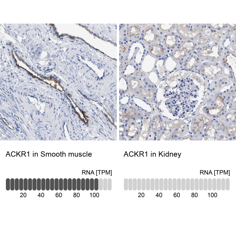 Anti-ACKR1 Antibody