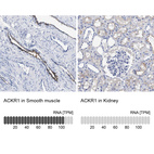 Anti-ACKR1 Antibody