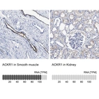 Anti-ACKR1 Antibody