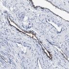 Anti-ACKR1 Antibody