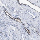 Immunohistochemical staining of human smooth muscle shows high expression.