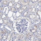 Immunohistochemical staining of human kidney shows low expression as expected.