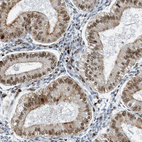 Anti-SH3D19 Antibody