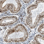 Immunohistochemical staining of human endometrium shows moderate nuclear/cytoplasmic-nuclear/nuclear membranous positivity in glandular cells and stromal cells.