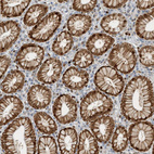 Immunohistochemical staining of human stomach shows strong cytoplasmic-nucleus positivity in glandular cells and nucleus positivity in lymphoid cells.
