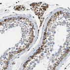 Anti-HSD17B12 Antibody