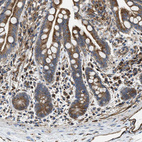 Immunohistochemical staining of human colon shows moderate to strong cytoplasmic positivity in glandular cells.