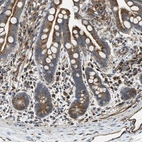 Immunohistochemical staining of human colon shows moderate to strong cytoplasmic positivity in glandular cells.