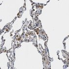 Anti-HSD17B12 Antibody